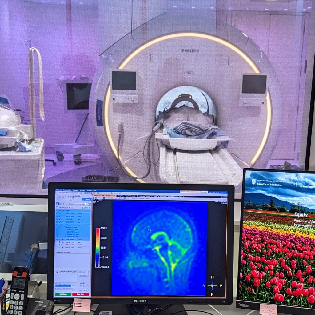 MRI research at UBC leaps forward with cutting-edge system upgrade - a ...